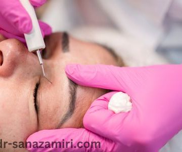 بلفاروپلاستی چیست؟