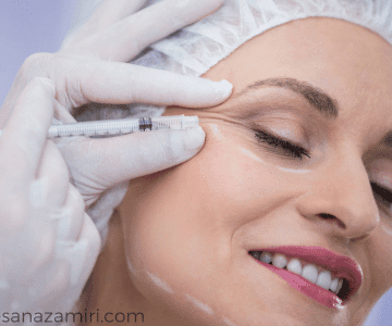 مراقب های پس از بوتاکس