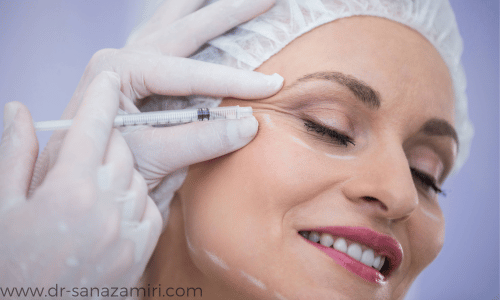 مراقب های پس از بوتاکس