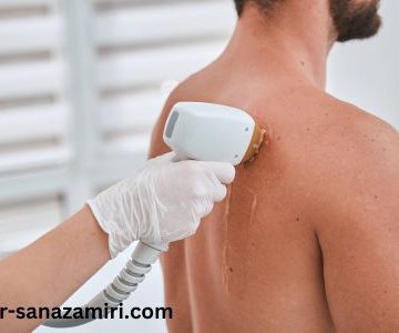 آیا نتایج لیزر موهای زائد برای همه یکسان است؟