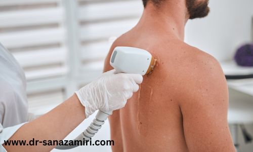 آیا نتایج لیزر موهای زائد برای همه یکسان است؟
