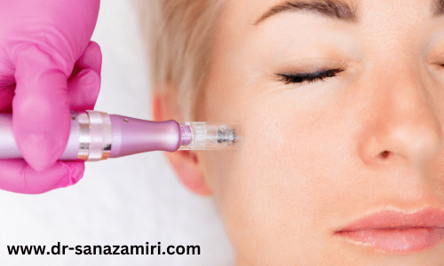 کربوکسی تراپی برای از بین بردن چربی شکم، پهلو و غبغب