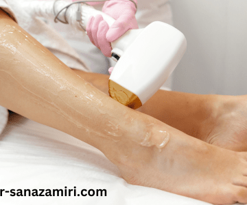 تفاوت لیزر و اپیلاسیون؛ کدام بهتر است؟