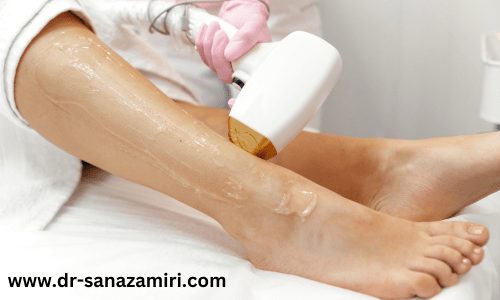 تفاوت لیزر و اپیلاسیون؛ کدام بهتر است؟