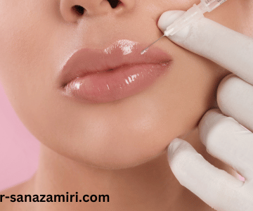 بعد از تزریق ژل لب چی بخوریم
