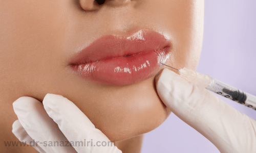 چند روز بعد از تزریق ژل لب میشه رژ زد