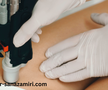 رفع تیرگی ناحیه بیکینی با لیزر CO2: یک راهکار موثر