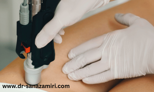 رفع تیرگی ناحیه بیکینی با لیزر CO2: یک راهکار موثر