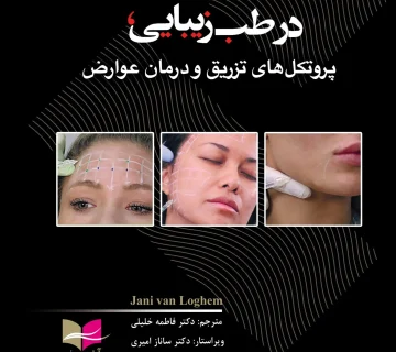 توکسین بوتولینوم در طب زیبایی، پروتکل های تزریق و درمان عوارض