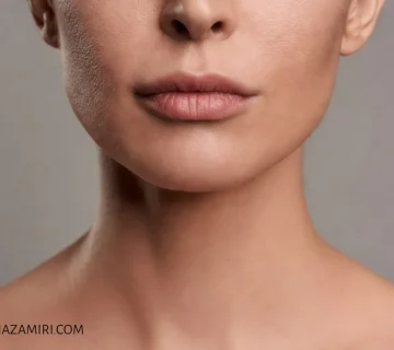 آیا فیلر زاویه فک برای صورت های لاغر مناسب است؟